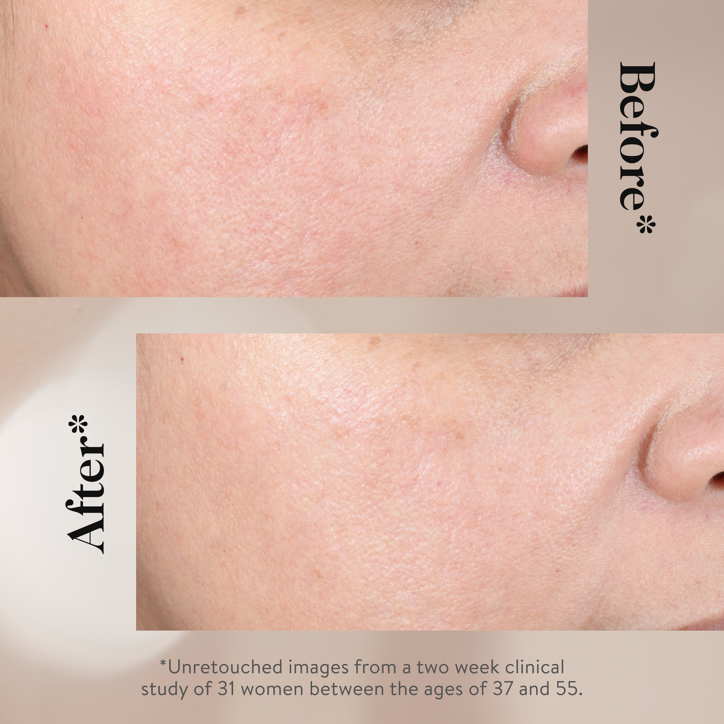 Glycolic Acid Overnight Glow Peel (12 Pack)