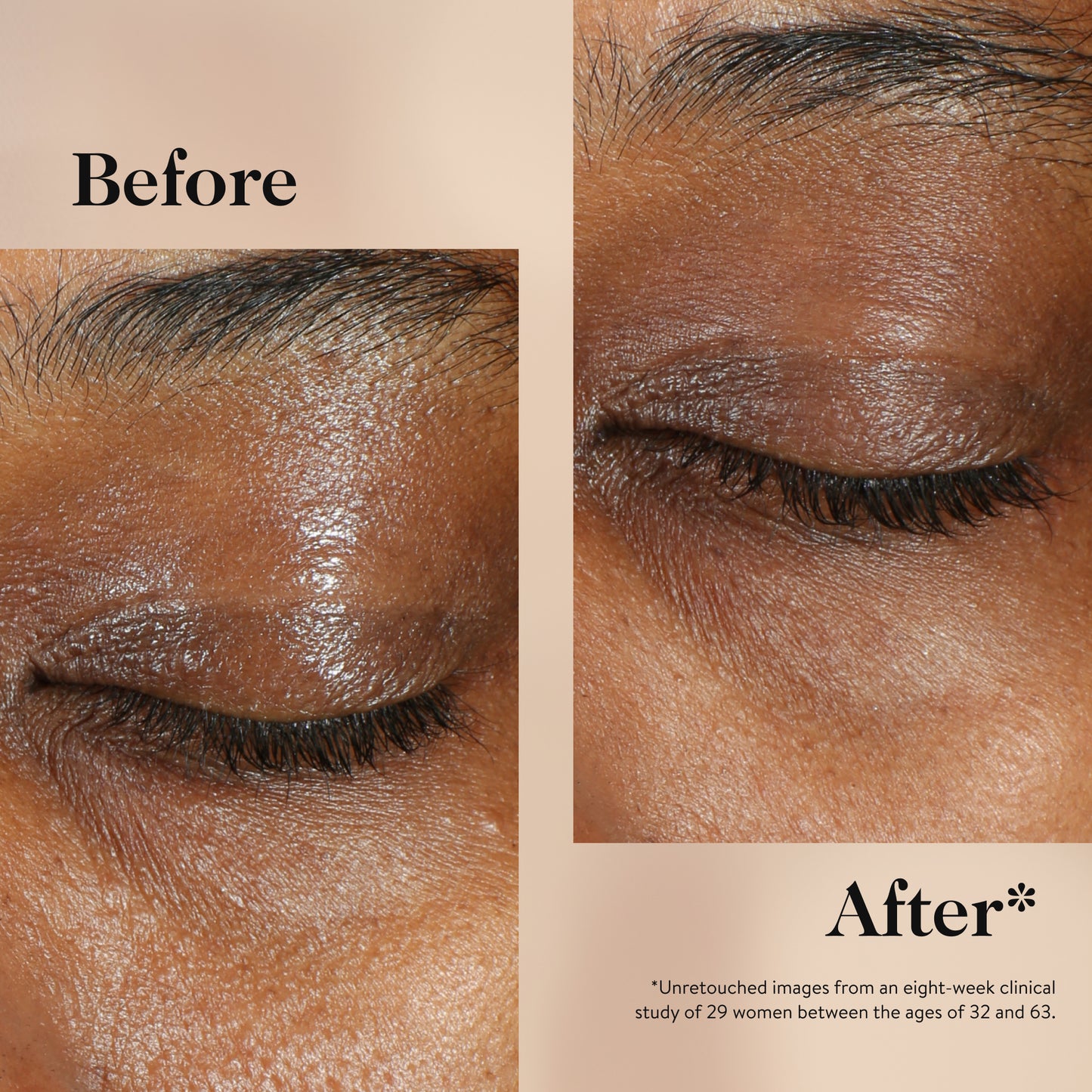 Vita-C Brightening Eye Cream